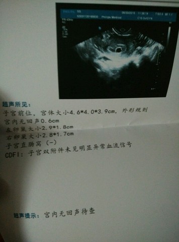 journal_insert_pic_282860320