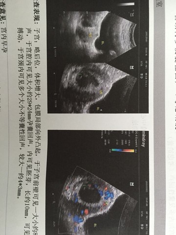 journal_insert_pic_285042348