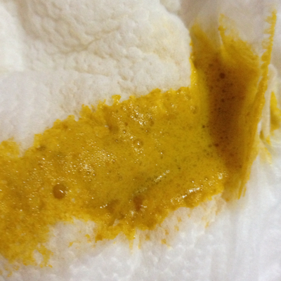 宝宝24天,最近几天一直拉泡沫状的粑粑怎么办