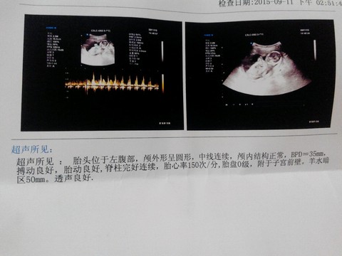journal_insert_pic_296270078