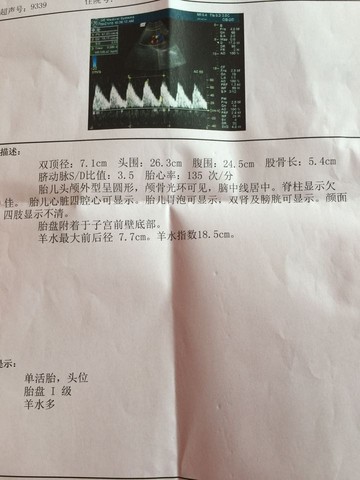 journal_insert_pic_302729368
