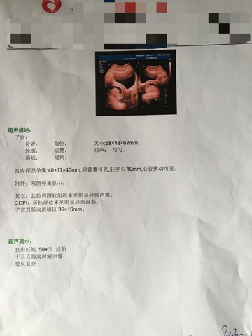 journal_insert_pic_304715980