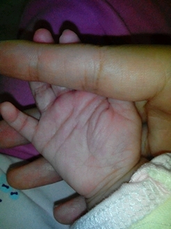 看看俺姑娘右手手纹是怎麼回事_宝宝树