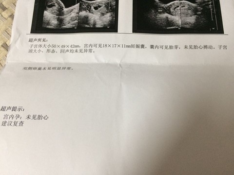 journal_insert_pic_311302693