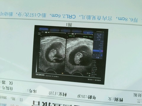 journal_insert_pic_313947929
