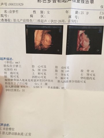 journal_insert_pic_315913660
