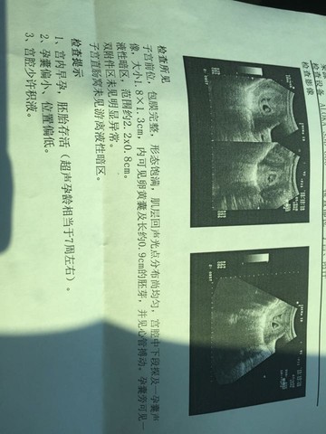 journal_insert_pic_318005201