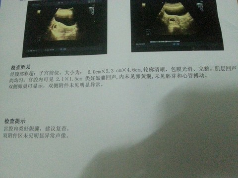 journal_insert_pic_320226713