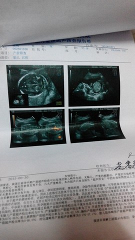 journal_insert_pic_322562140