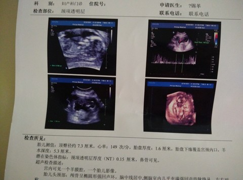 journal_insert_pic_328521167