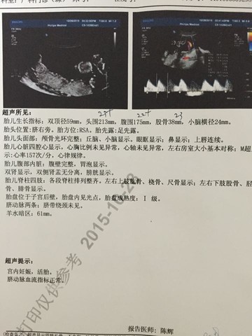 journal_insert_pic_328418533