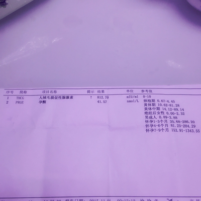 刚怀孕,hcg值是多少,我这个是不是高了