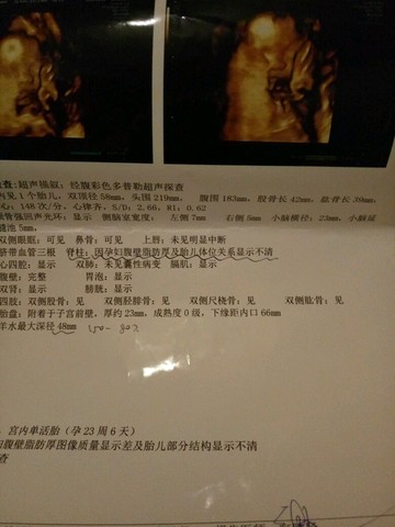 journal_insert_pic_334267311