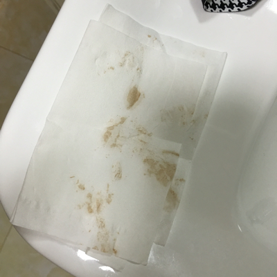 怀孕第33天,见红,淡淡血水,这是怎麼回事?孕酮值都正常.