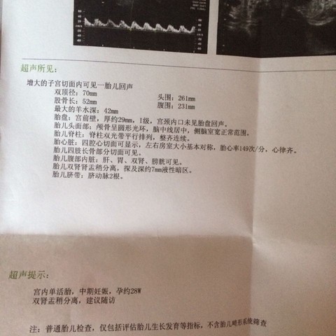 journal_insert_pic_335944122