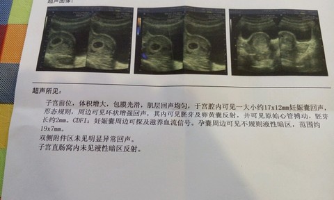 journal_insert_pic_338616177