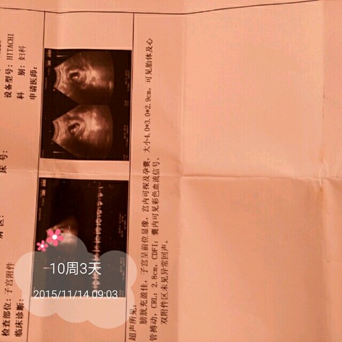 journal_insert_pic_338648258