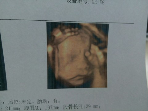 journal_insert_pic_338782154