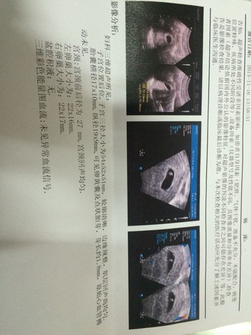 journal_insert_pic_339301852
