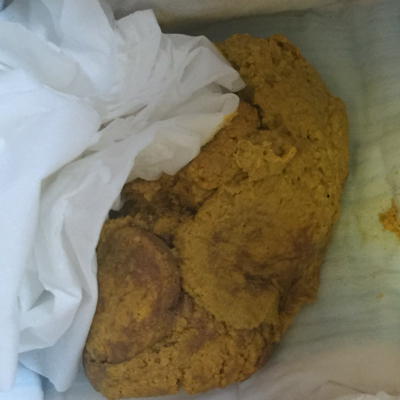 宝宝50天,昨天一天没有拉粑粑,今天晚上窝的粑粑刚刚出来的一大堆特别