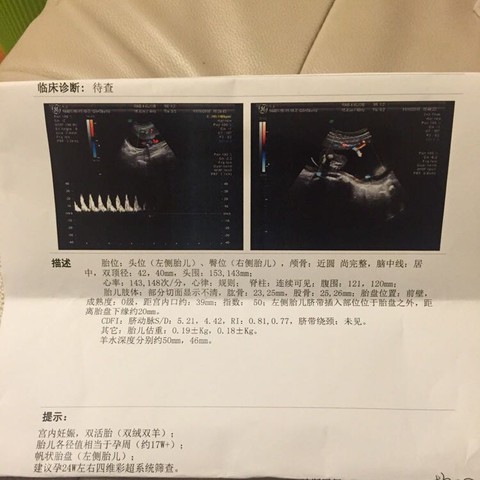 journal_insert_pic_341031815