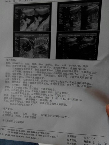 journal_insert_pic_341540981