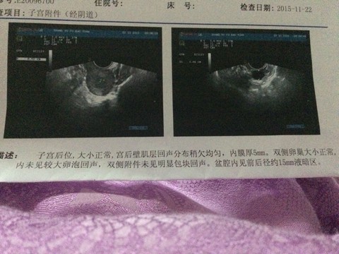 journal_insert_pic_345144341