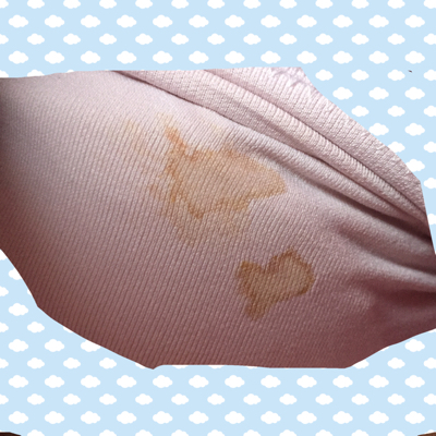 怀孕37周了,乳头痒,还分泌了黄色液体还挺多的,用手挤也没挤出来水,都