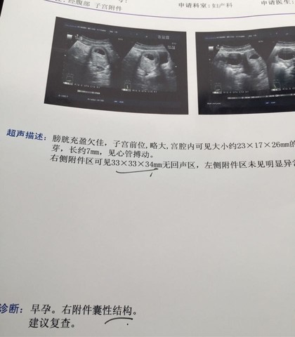 journal_insert_pic_349964549