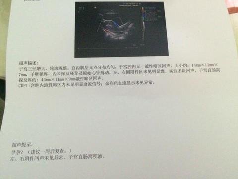 journal_insert_pic_351074588