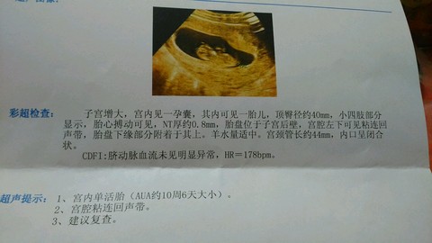 journal_insert_pic_351593813