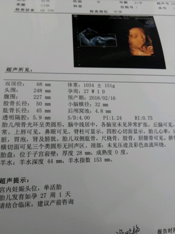 journal_insert_pic_352933046