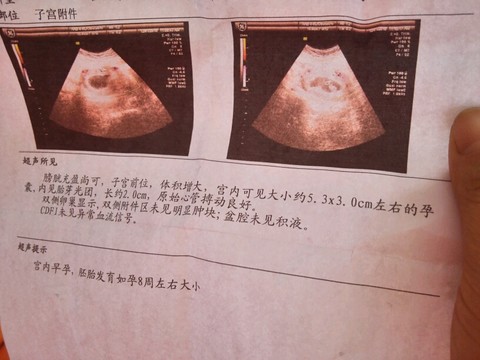 journal_insert_pic_354797894