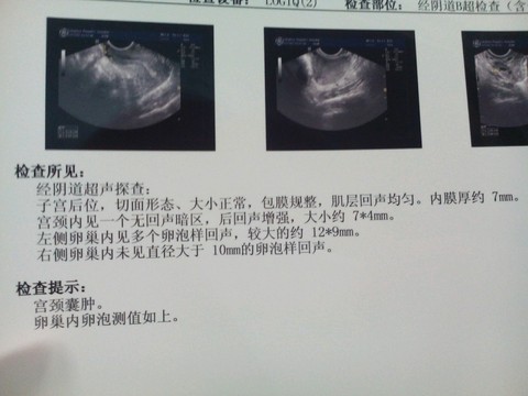 journal_insert_pic_355612249