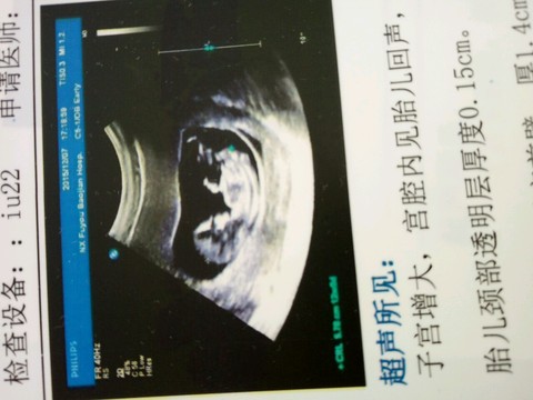 journal_insert_pic_356123644