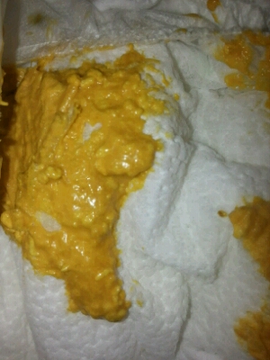 问答 婴儿期0-1岁 宝宝树孕育 90%的妈妈正在使用 宝宝树孕育 90%的