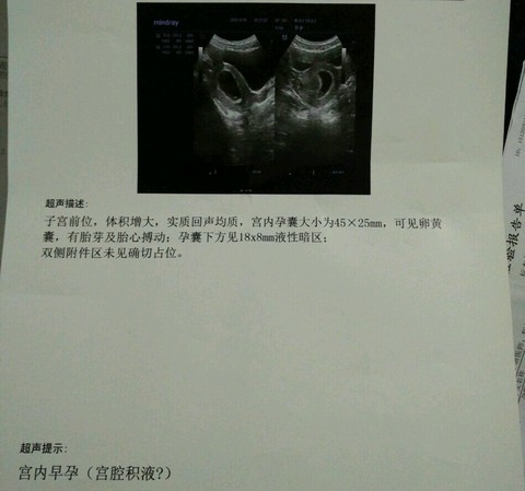 journal_insert_pic_360392420