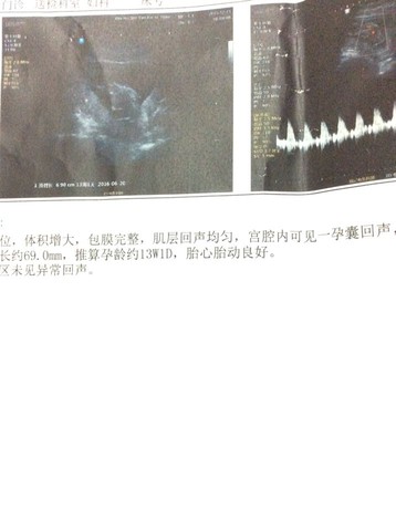 journal_insert_pic_377205565