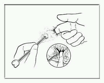 1岁宝宝大便"下蛋",医生道出真相后,儿媳和婆婆彻底闹翻了