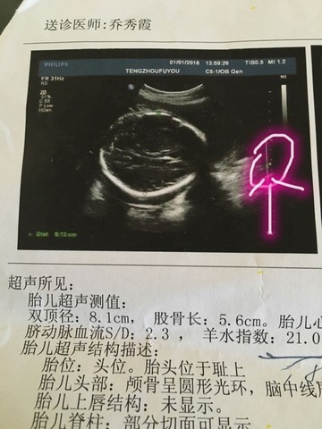 journal_insert_pic_387459245