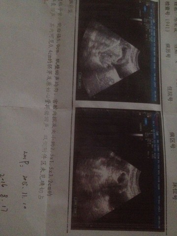journal_insert_pic_389166384