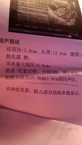 journal_insert_pic_390414926