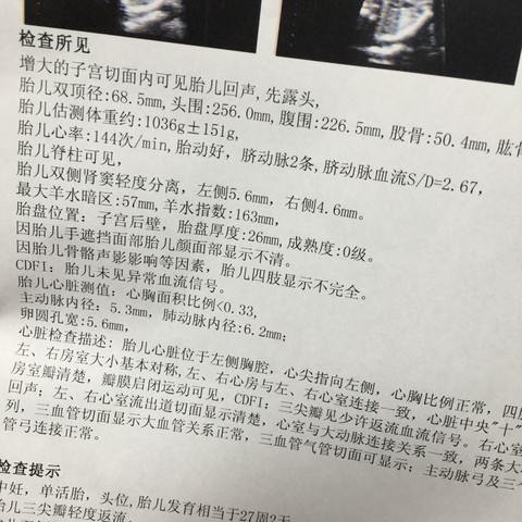journal_insert_pic_390219208