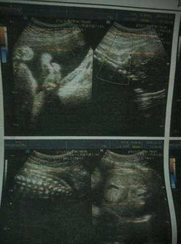 journal_insert_pic_393245106