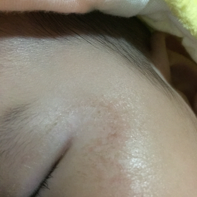 有谁知道宝宝眼角这些是什麼?