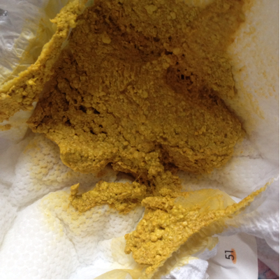 新生儿大便有奶瓣怎麼办