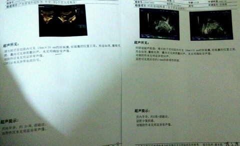 journal_insert_pic_397691102