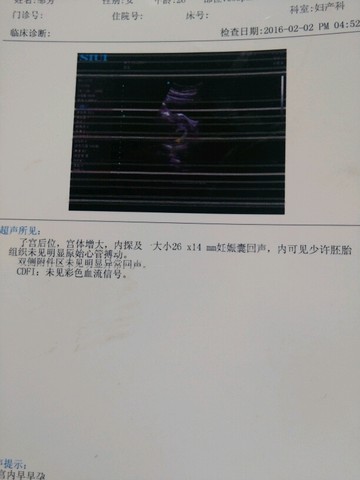 journal_insert_pic_399751784