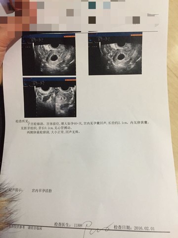 journal_insert_pic_400347789