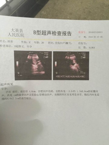 journal_insert_pic_406107364
